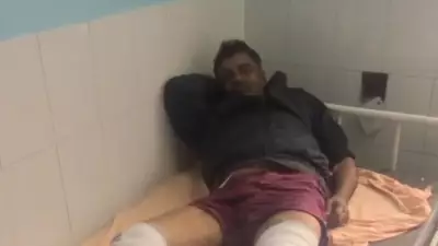 Wanted Criminal with ₹1 Lakh Reward Shot, Arrested After Gurgaon Encounter