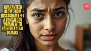 Bengaluru Woman Files Police Complaint Against Instagram Beauty Clinic After Skin Damage