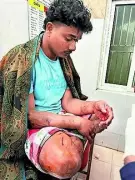 Farmer Survives Leopard Attack in Odisha, Animal Dies in Self-Defense Struggle