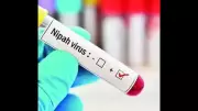 Health Ministry Assures Nipah Virus Under Control in West Bengal Amid Neighbouring Nations' Screening