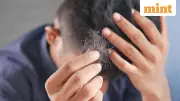 India to Regulate Hair Transplant Industry, Ban Salons from Surgical Procedures