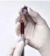 Kurnool Police Arrest 4 for Injecting HIV-Infected Blood into Doctor