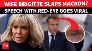 Macron's Red Eye Sparks Rumors of Clash with Brigitte, French President Denies