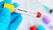 Nipah Virus Returns: Two Critical Cases in West Bengal, 90 Contacts Traced