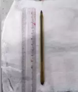 Pen Swallowed in Bet Remains in Teen's Abdomen for 3 Years, Removed in Guntur