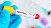 Two Bengal Nurses on Ventilator with Critical Nipah Virus Symptoms