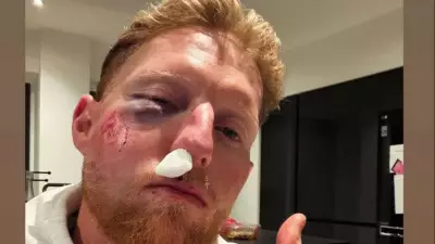 England Captain Ben Stokes Suffers Gruesome Injury During Nets Session, Shares Photo