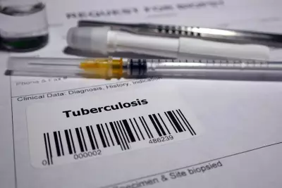 ICMR Study Finds Shorter Oral Regimens for Drug-Resistant TB Cost-Effective in India