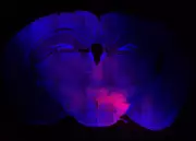 Bengaluru Scientists Discover Brain Circuit That Suppresses Itching During Stress