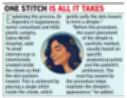 Bengaluru Sees Surging Demand for Artificial Dimple Surgery Among Women