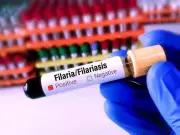 Bihar Launches Mass Drug Drive to Eliminate Filariasis, Targets 8.93 Crore People