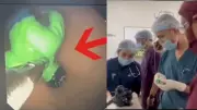 Gujarat Boy Swallows Hulk Toy, Doctors Perform Life-Saving Endoscopic Removal