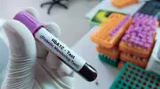HbA1c Test May Mislead Diabetes Diagnosis in India, Lancet Review Warns