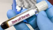 Inside India's Stem Cell Therapy Labs: High Costs, Complex Procedures