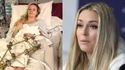 Lindsey Vonn's Olympic Dream Ends with Third Surgery, Father Confirms Career Over