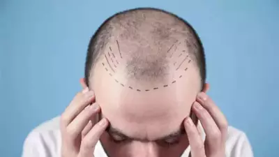 Doctors Demand National Regulations for Hair Transplant and Cosmetic Clinics