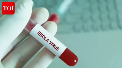 Ebola Virus May Linger in Breast Milk for Weeks After Recovery, Study Finds