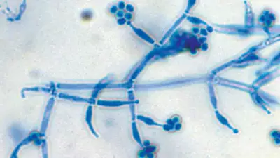 Trichoderma: The Green Guard Fungus That Protects and Boosts Indoor Plants