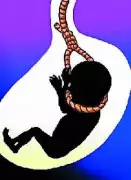 Darbhanga Woman Accuses Live-in Partner of Forced Abortions, Death Threats