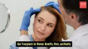Hair Transplants for Women: A Growing Trend Beyond the Male Stereotype