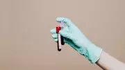 Normal Blood Tests Can Hide Early Metabolic Risks: Key Markers to Watch