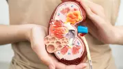 Protein Powders & High-Protein Diets: Kidney Experts Reveal Hidden Risks