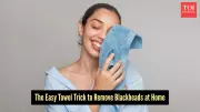 Simple Towel Trick for Blackheads: An Affordable Skincare Solution