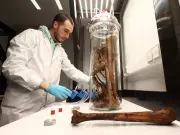 Stressful Relationships May Accelerate Biological Aging, New Study Reveals