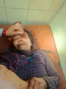 Uttarakhand Woman Fights Off Leopard Attack with Sickle in Pithoragarh Village