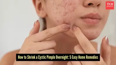 5 Simple Home Remedies to Shrink a Cystic Pimple Overnight