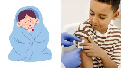 Bangladesh Measles Outbreak Prompts Health Alert for India