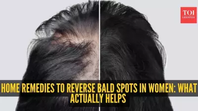 Effective Home Remedies for Sudden Bald Spots in Women