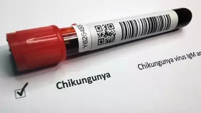 Kerala's Ernakulam Reports Chikungunya Cases, Health Surveillance Ramped Up