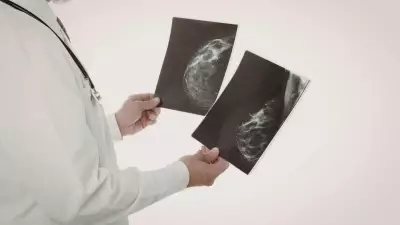 Mammograms May Reveal Hidden Heart Disease Risk in Women