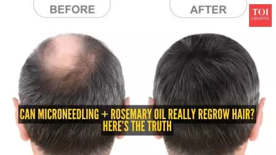 Microneedling and Rosemary Oil for Hair Loss: Science and Routine