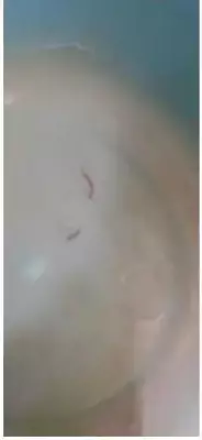 Pimpri Chinchwad Water Crisis: Residents Report Muddy, Sewage-Mixed Supply with Worms