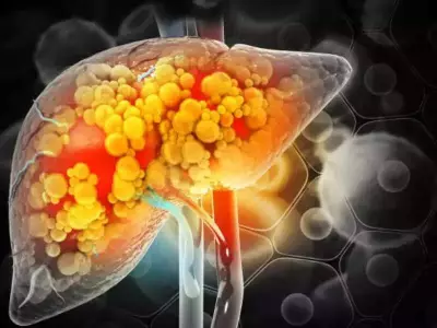 Study Reveals Silent Liver Failure Risk as Fourth Major Diabetes Complication