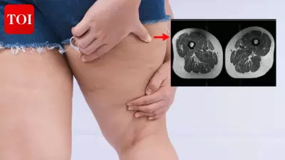 Ultra-Processed Foods Linked to Fat Buildup in Thigh Muscles, Study Finds