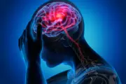 1 in 7 Stroke Patients in India Are Aged 18-44: ICMR Study