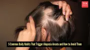 Alopecia Areata: 5 Common Habits That Trigger Hair Loss and How to Manage Them
