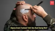 Alopecia Areata Myth Debunked: Does Shaving Your Head Really Help Hair Regrowth?