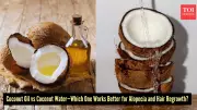 Alopecia Areata Remedies: Coconut Oil vs Coconut Water - Which is More Effective?