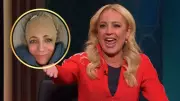 Carrie Bickmore Reveals Plastic Surgery Needed After Painful Head Injury at Home