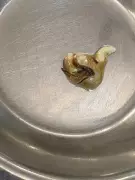 Delhi Medical College Students Protest Over Food Safety, Stray Dogs, Poor Living Conditions