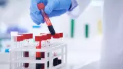 Goa Partners with Anjani Mashelkar Foundation for Affordable Health Diagnostics