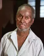 Mangaluru Blast Victim Disappointed with 10-Year Sentence for Accused