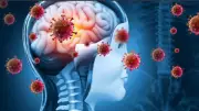 New Meningitis B Cases Emerge in Weymouth, UK, Following Kent Outbreak