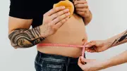Obesity Deserves Routine Screening Like Blood Pressure, Experts Say