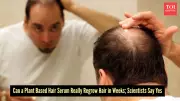 Scientists Develop Plant-Based Serum for Faster Hair Regrowth in 56 Days