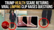Trump's Health Under Renewed Scrutiny After Viral Limping Clip Sparks Online Debate